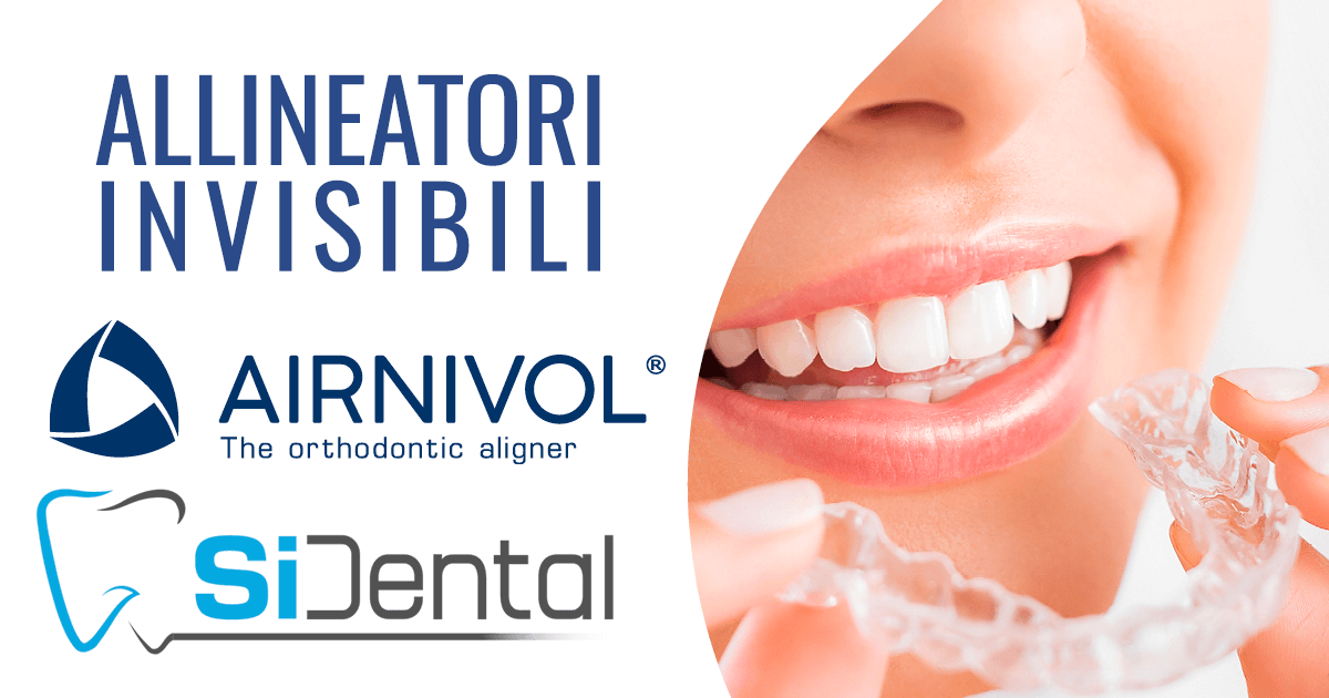 Allineatori invisibili a Sinalunga, un'alternativa all'apparecchio tradizionale